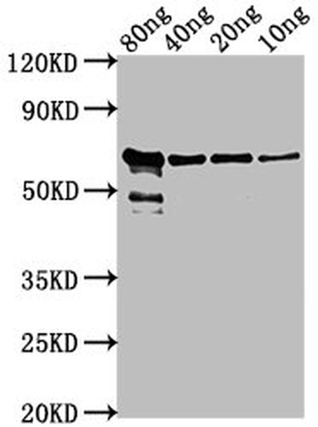 Chicken Anemia Virus VP2 Antibody in Western Blot (WB)