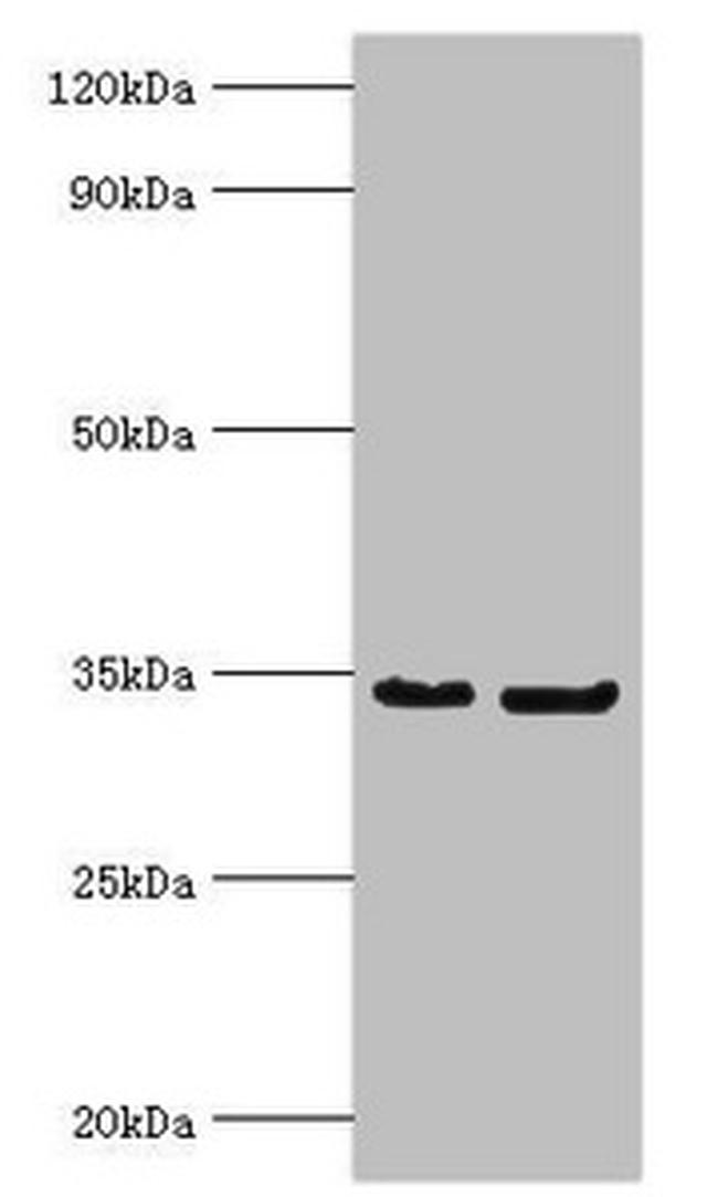 Rabies Virus Phosphoprotein Antibody in Western Blot (WB)