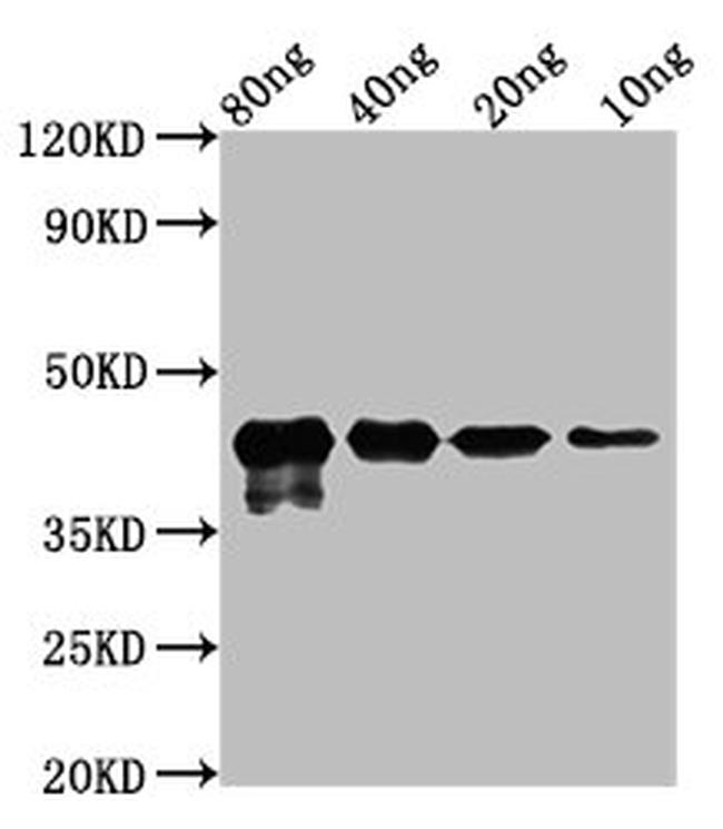 Mycoplasma pneumoniae MPN-083 Antibody in Western Blot (WB)
