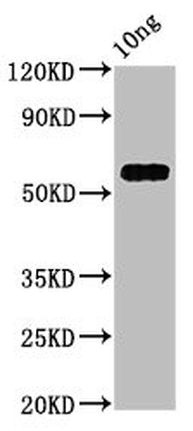 Candida albicans PRA1 Antibody in Western Blot (WB)