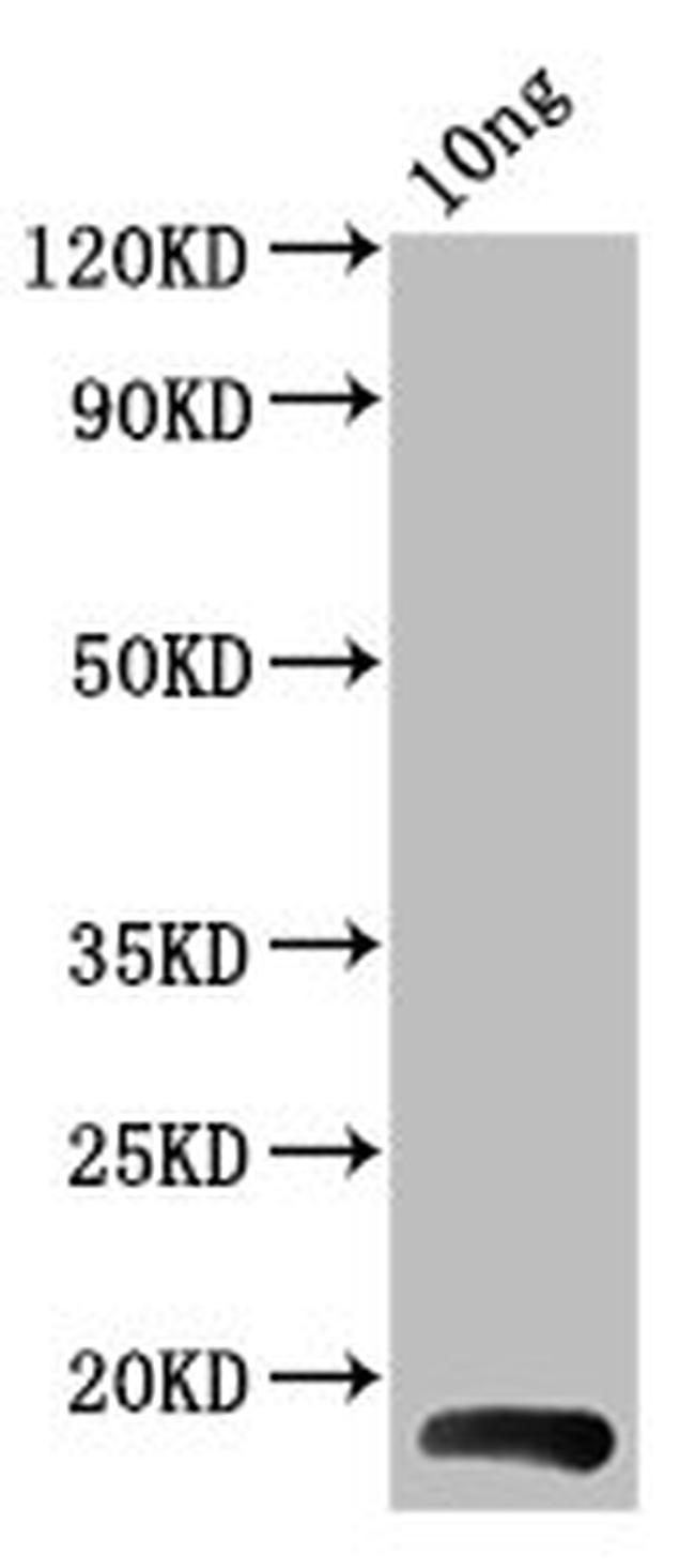 Epstein Barr Virus BHRF1 Antibody in Western Blot (WB)