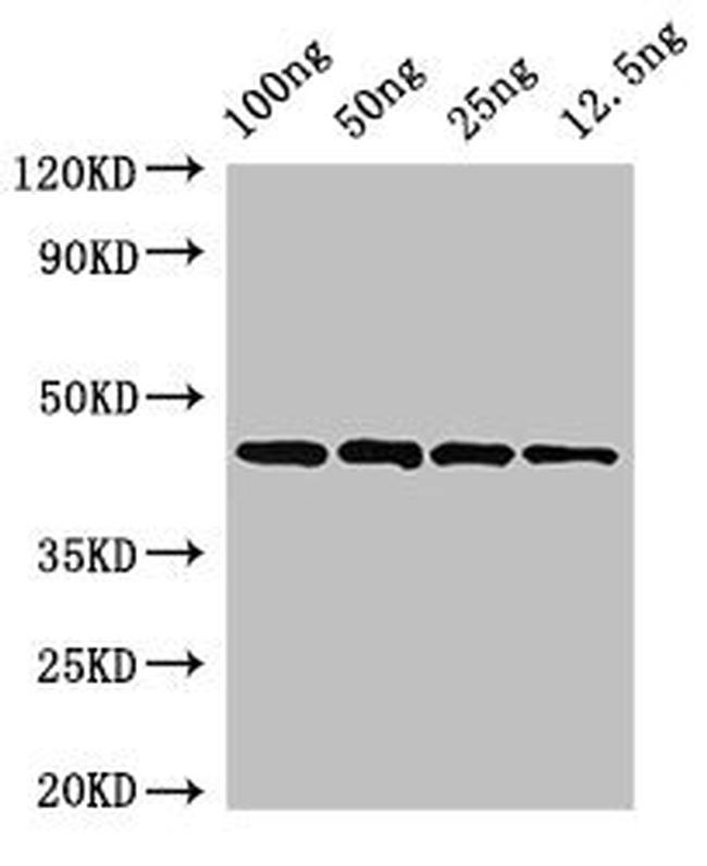 Streptococcus pyogenes speB Antibody in Western Blot (WB)