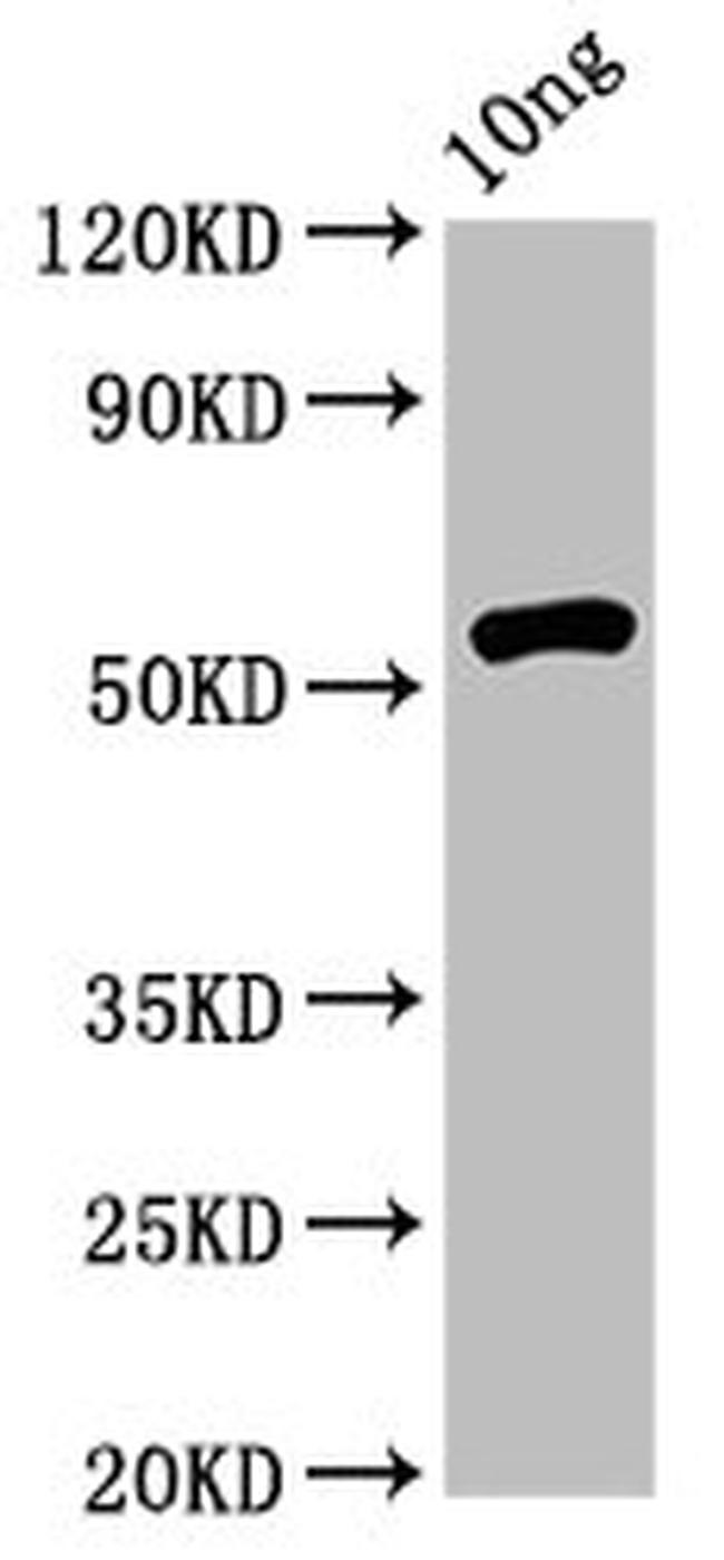Rhodobacter sphaeroides rsrIM Antibody in Western Blot (WB)