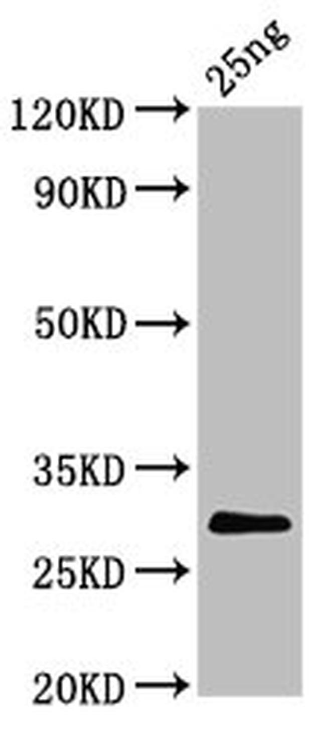 Bovine Coronavirus Spike Protein Antibody in Western Blot (WB)