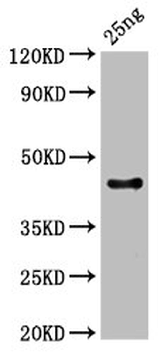 Rabies Virus Protein C Antibody in Western Blot (WB)