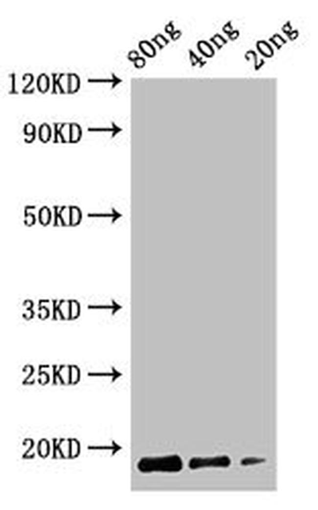 Bacillus macerans CGTase Antibody in Western Blot (WB)