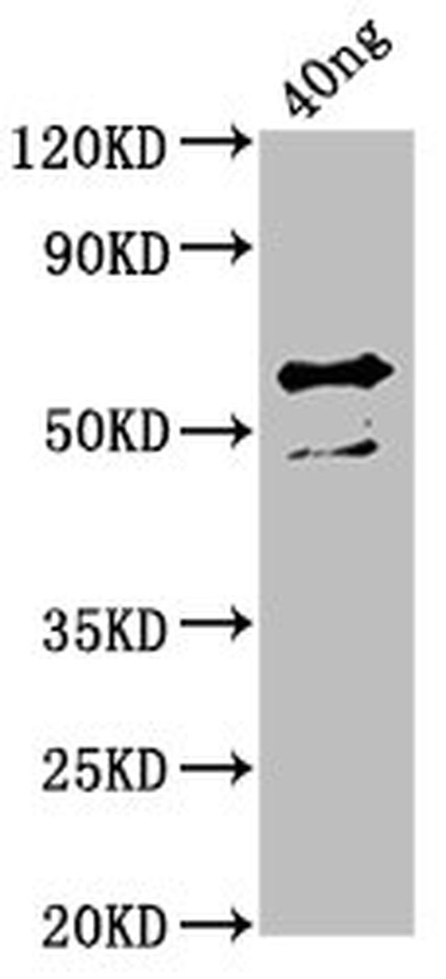Haemophilus influenzae ompA Antibody in Western Blot (WB)
