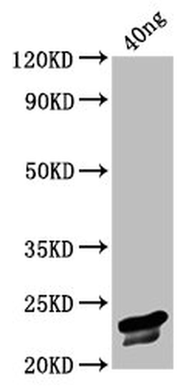 Fail Vp3 Chicken Anemia Virus VP3 Polyclonal Antibody (PA5-117595)