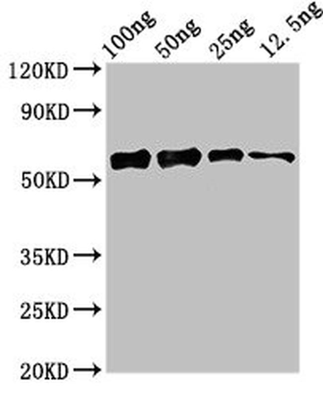 Staphylococcus aureus ALD1 Antibody in Western Blot (WB)