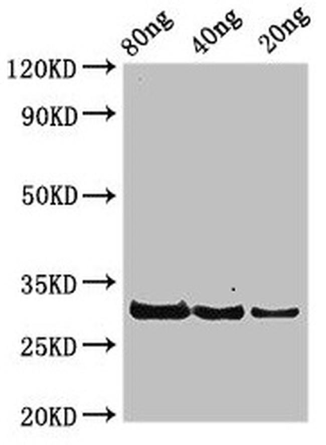 Staphylococcus aureus rplL Antibody in Western Blot (WB)