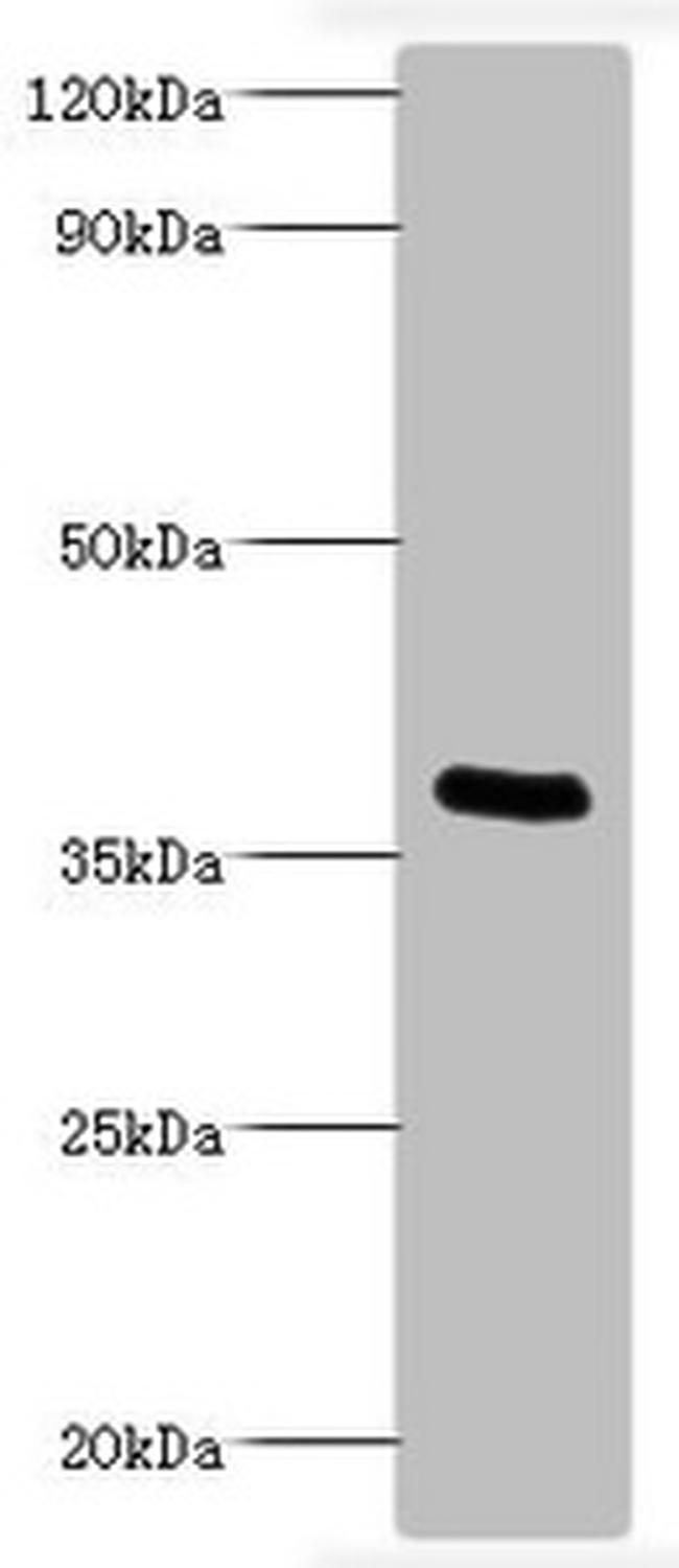 Bordetella pertussis ptxA Antibody in Western Blot (WB)