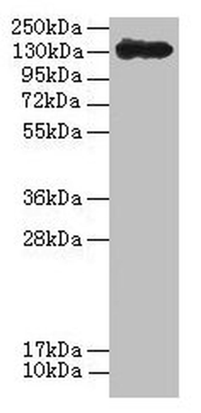 Bacillus thuringiensis subsp. Kurstaki Cry1Ac Antibody in Western Blot (WB)