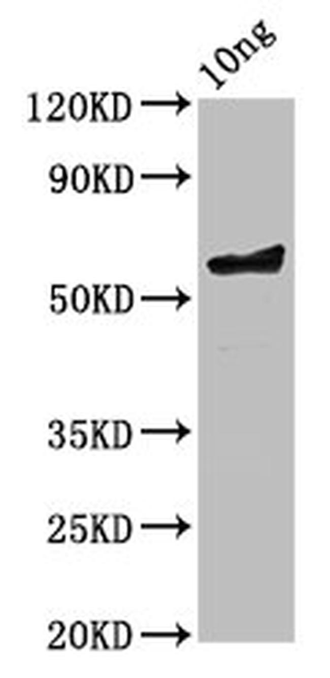 Chlamydia trachomatis serovar L2 ompA Antibody in Western Blot (WB)