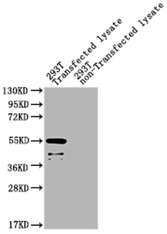 Staphylococcus aureus Exfoliative toxin A Antibody in Western Blot (WB)