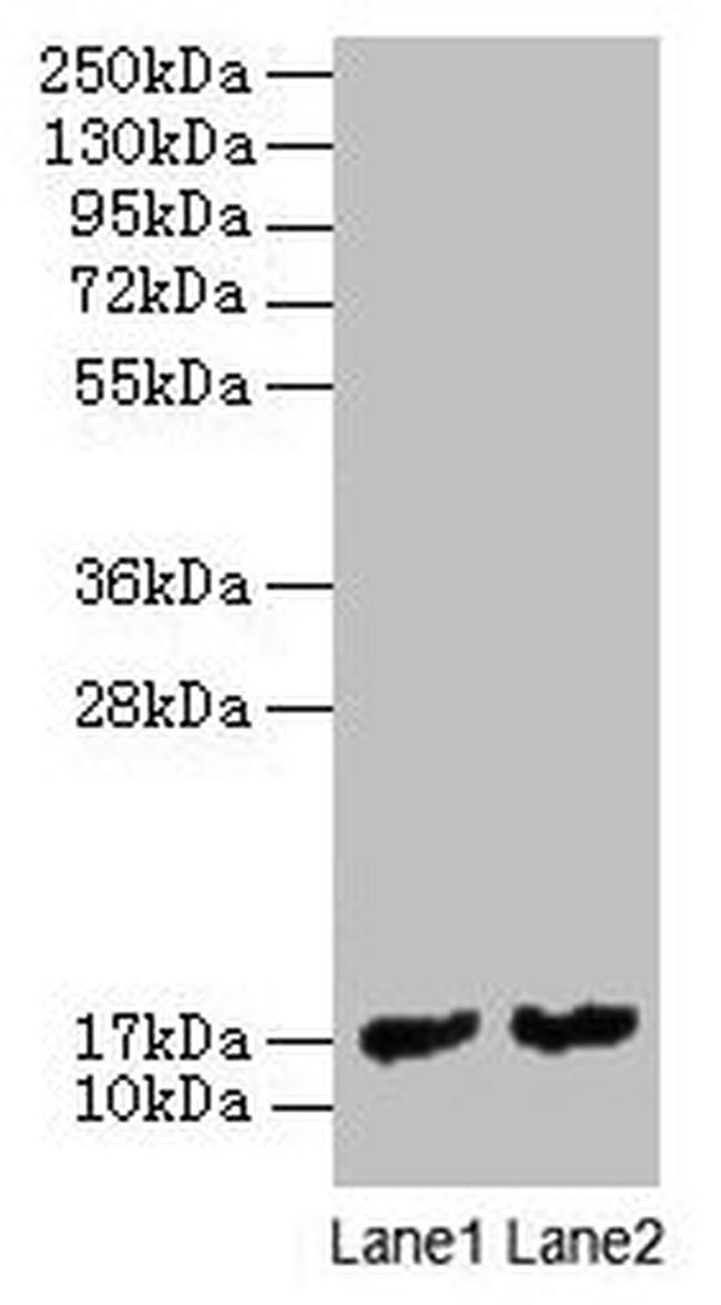 Mycobacterium tuberculosis MPT63 Antibody in Western Blot (WB)