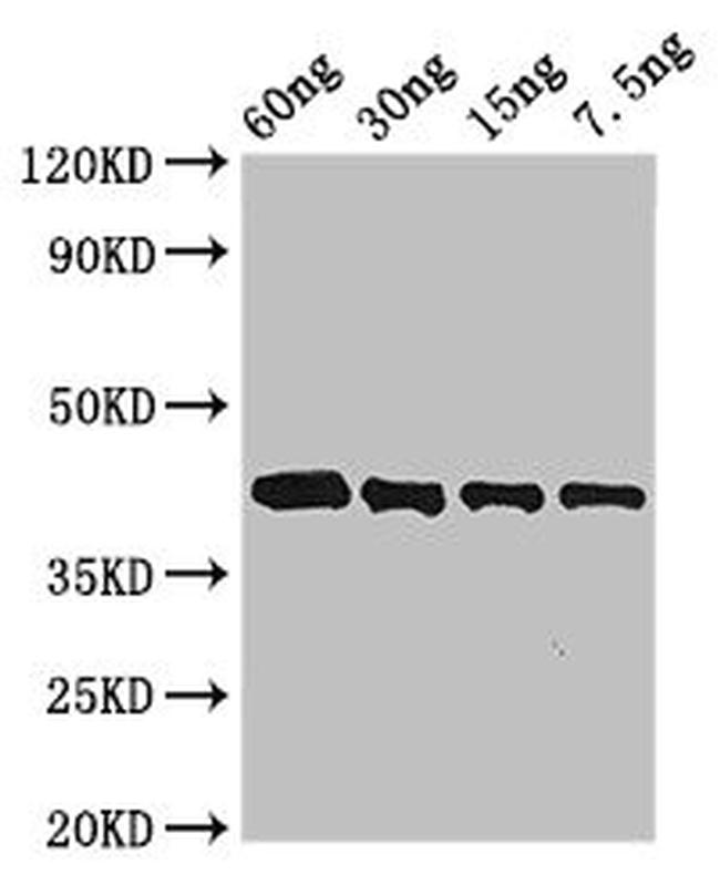 Arginine esterase Antibody in Western Blot (WB)
