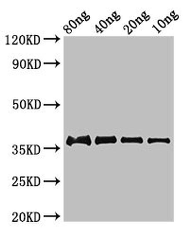 Mycobacterium tuberculosis Ag85C Antibody in Western Blot (WB)
