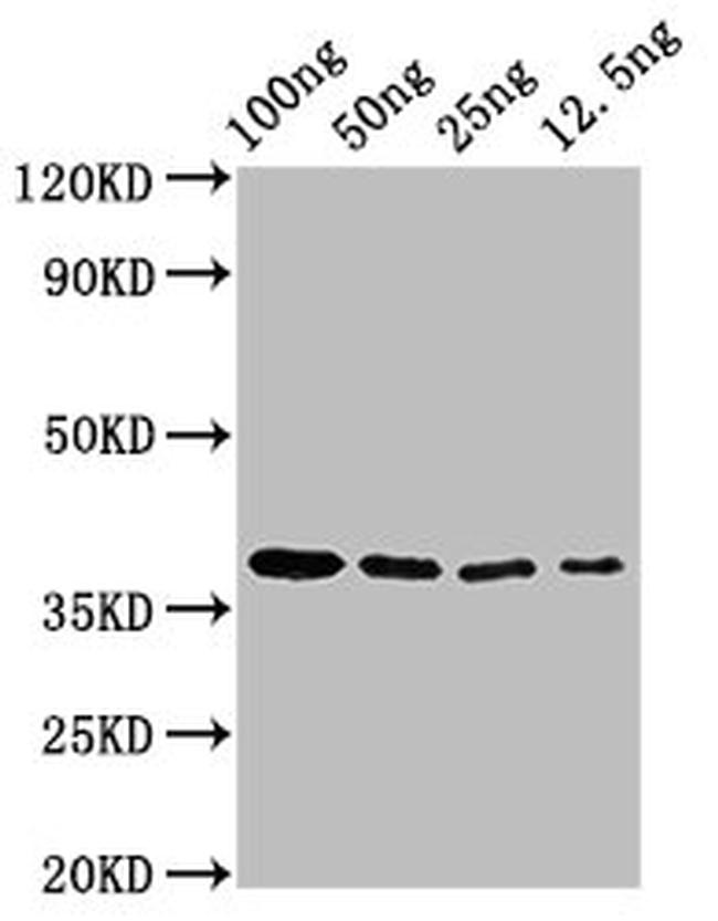 Epstein Barr Virus BZLF2 Antibody in Western Blot (WB)