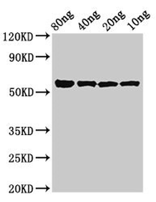 Porphyromonas gingivalis kgp Antibody in Western Blot (WB)