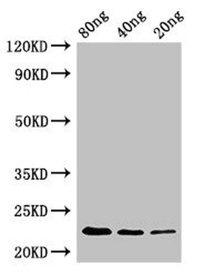 Laribacter hongkongensis pyrE Antibody in Western Blot (WB)