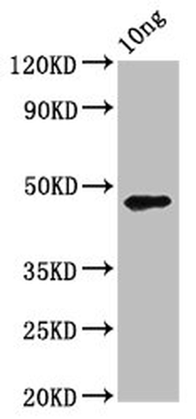 Chlamydia trachomatis pmpD Antibody in Western Blot (WB)