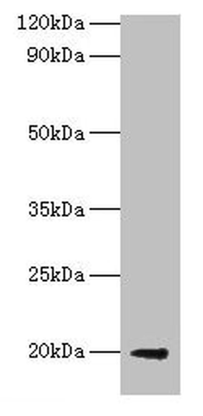 E. coli luxS Antibody in Western Blot (WB)