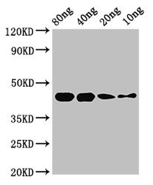 Streptococcus pyogenes serotype M28 speB Antibody in Western Blot (WB)