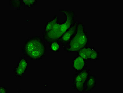 GLE1 Antibody in Immunocytochemistry (ICC/IF)