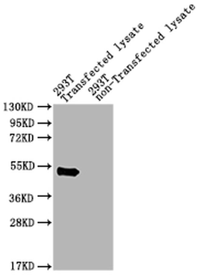 Streptomyces viridochromogenes pat Antibody in Western Blot (WB)