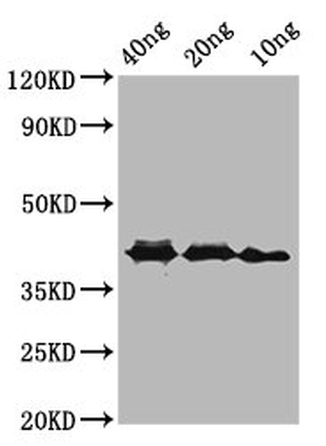 Rickettsia conorii ompA Antibody in Western Blot (WB)
