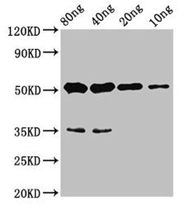 CYP26B1 Antibody in Western Blot (WB)