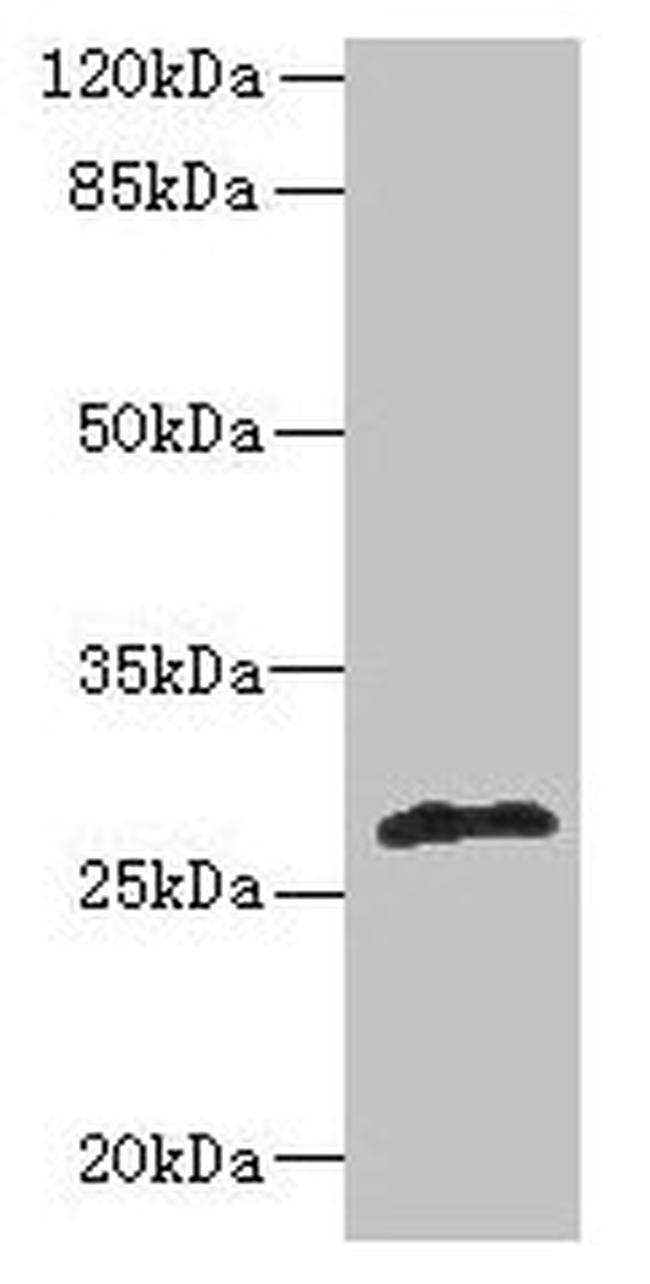 FABI Antibody in Western Blot (WB)