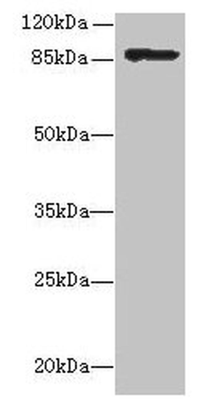 Listeria monocytogenes serotype 4b Internalin A Antibody in Western Blot (WB)
