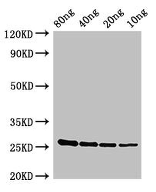 Staphylococcus aureus esxA Antibody in Western Blot (WB)