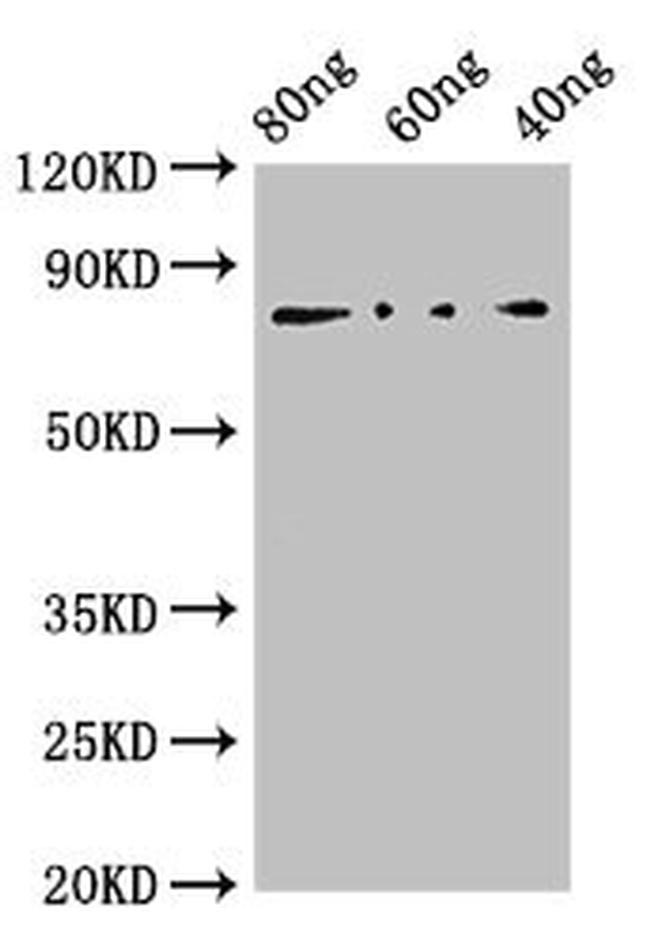 Reston Ebolavirus Nucleoprotein Antibody in Western Blot (WB)