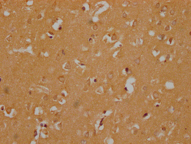 OR6B3 Antibody in Immunohistochemistry (Paraffin) (IHC (P))