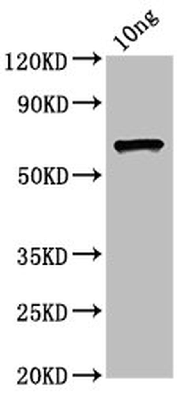 E. coli O157:H7 ompC Antibody in Western Blot (WB)