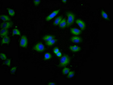 CLPTM1L Antibody in Immunocytochemistry (ICC/IF)
