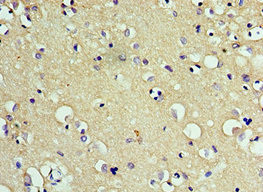 CD200R Antibody in Immunohistochemistry (Paraffin) (IHC (P))