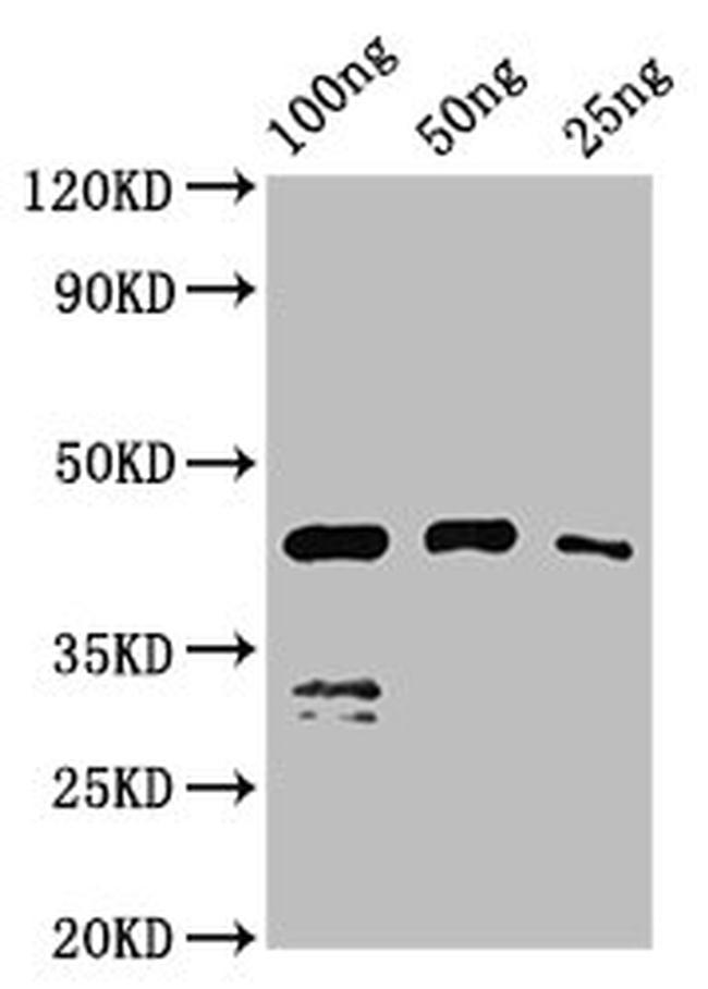 Chicken Anemia Virus VP1 Antibody in Western Blot (WB)