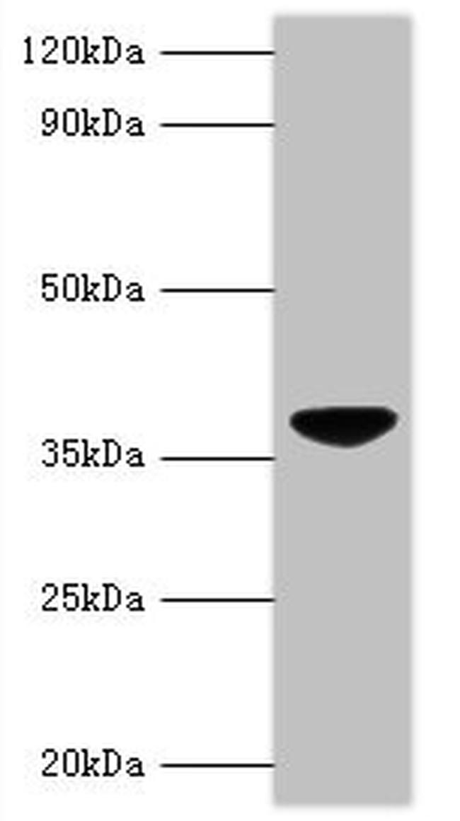 Chicken Anemia Virus VP3 Antibody in Western Blot (WB)