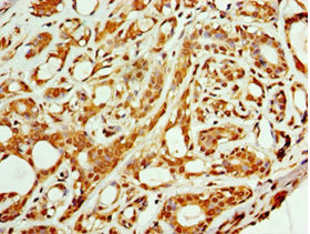 ARFGAP3 Antibody in Immunohistochemistry (Paraffin) (IHC (P))
