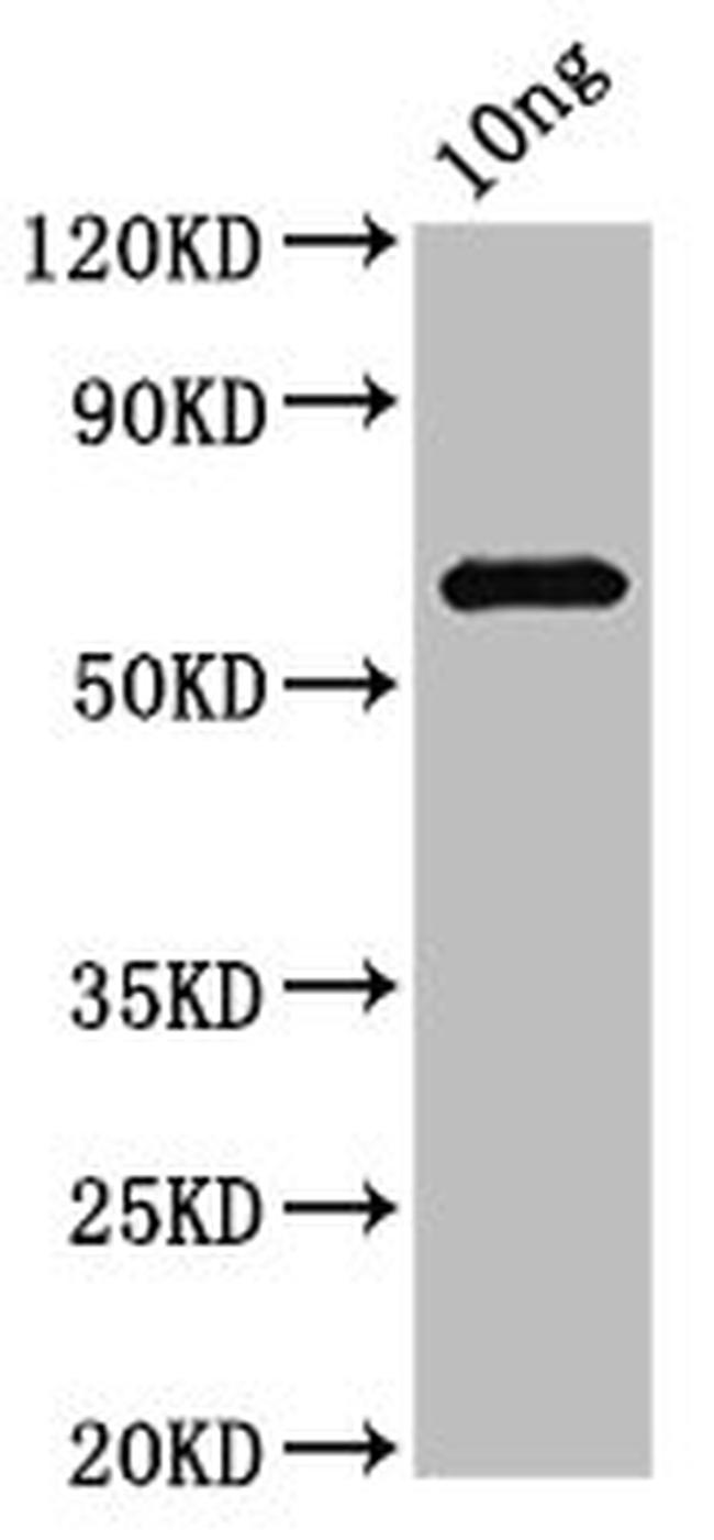 Porphyromonas gingivalis Peptidylarginine Deiminase Antibody in Western Blot (WB)
