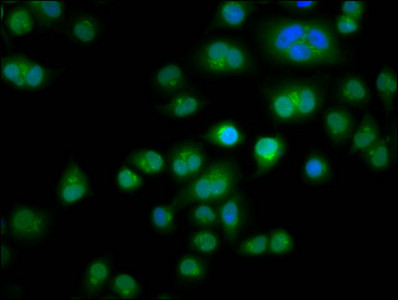 TES Antibody in Immunocytochemistry (ICC/IF)