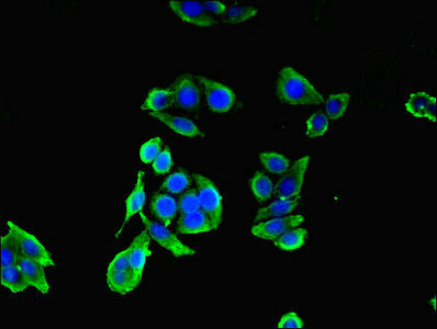 CEP83 Antibody in Immunocytochemistry (ICC/IF)