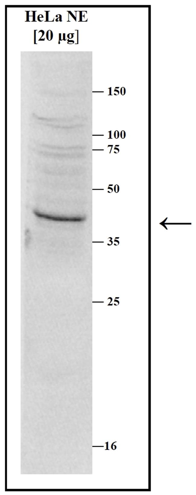 SETD8 Antibody in Western Blot (WB)
