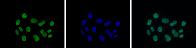 H3K9acK14ac Antibody in Immunocytochemistry (ICC/IF)