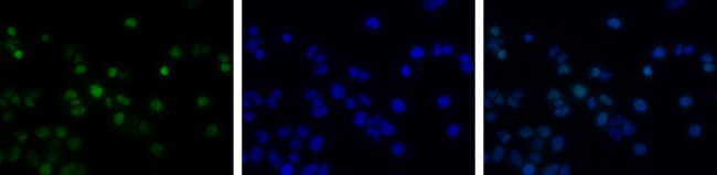 Phospho-Histone H2A.X (Ser139) Antibody in Immunocytochemistry (ICC/IF)