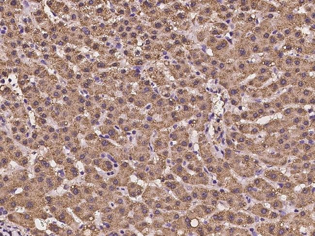 ACAT2 Antibody in Immunohistochemistry (Paraffin) (IHC (P))