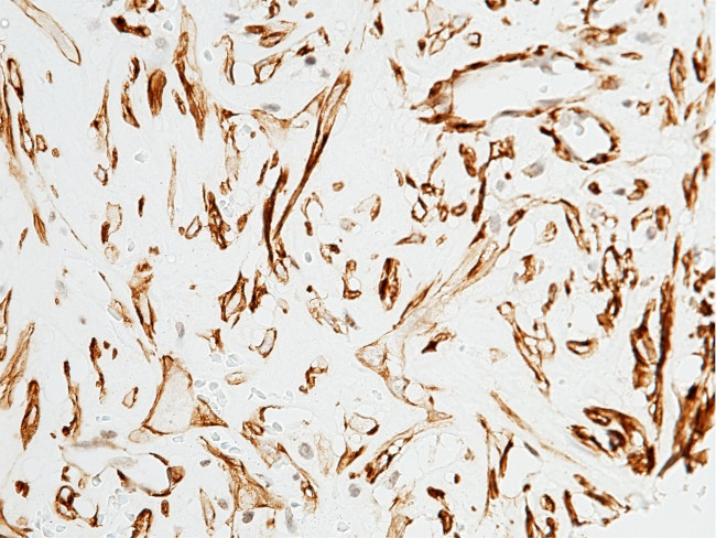 Alpha-Smooth Muscle Actin Antibody in Immunohistochemistry (Paraffin) (IHC (P))